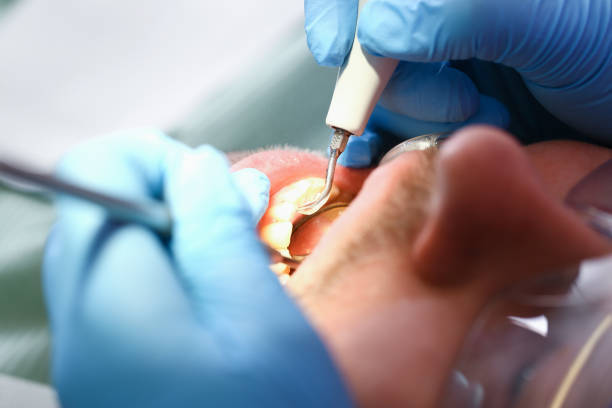 Best Emergency Dental Care for Broken or Chipped Teeth in Middle River, MD